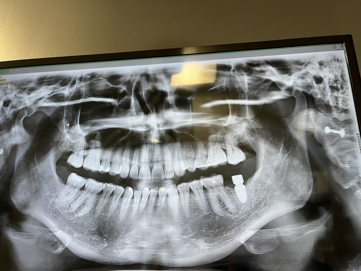 Torrance Oral Surgery Center photo 6