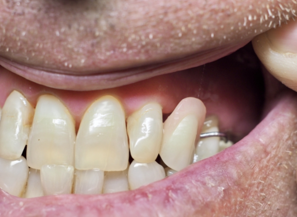 Aspen Dental - Yakima photo 5