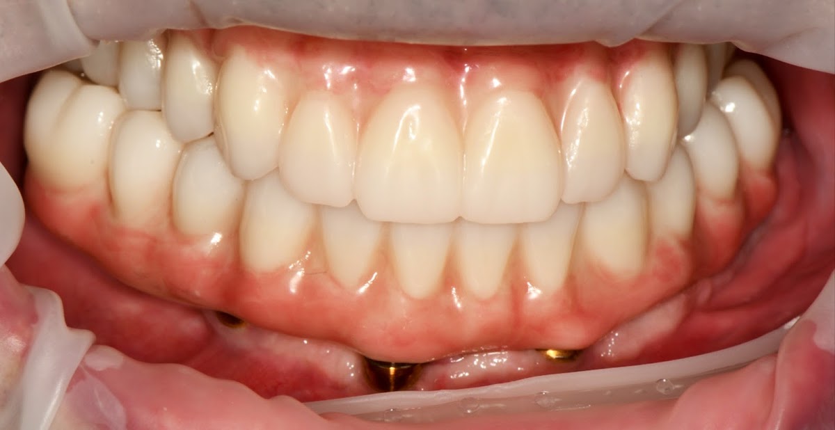 Bright Dental photo 3