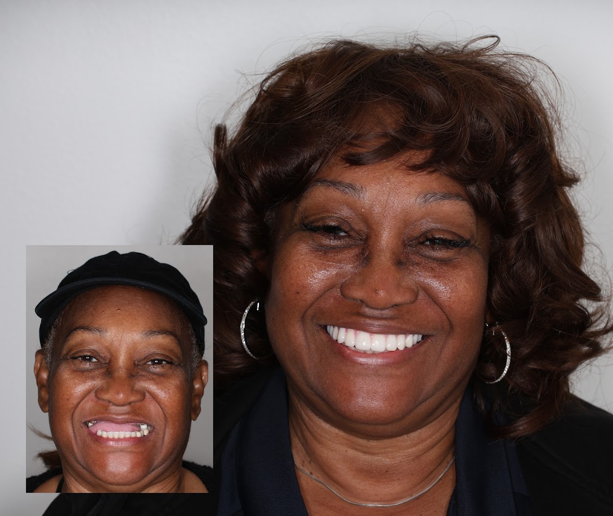 North County Dental Implant Center photo 6