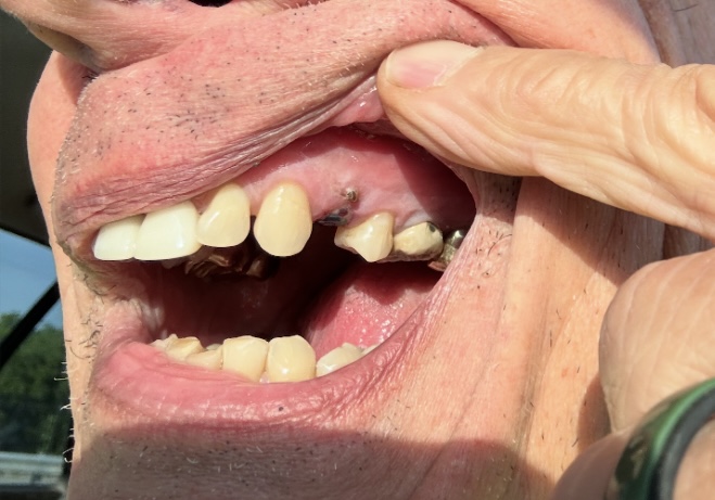 Midwest Oral Surgery & Dental Implants photo 6