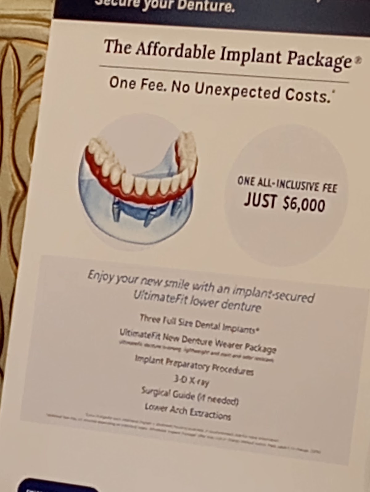 Affordable Dentures & Implants - Anderson photo 5
