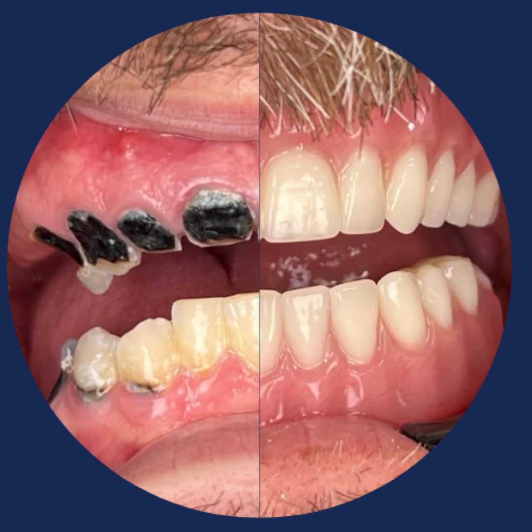 Britely Dentures + Implants Studio photo 6