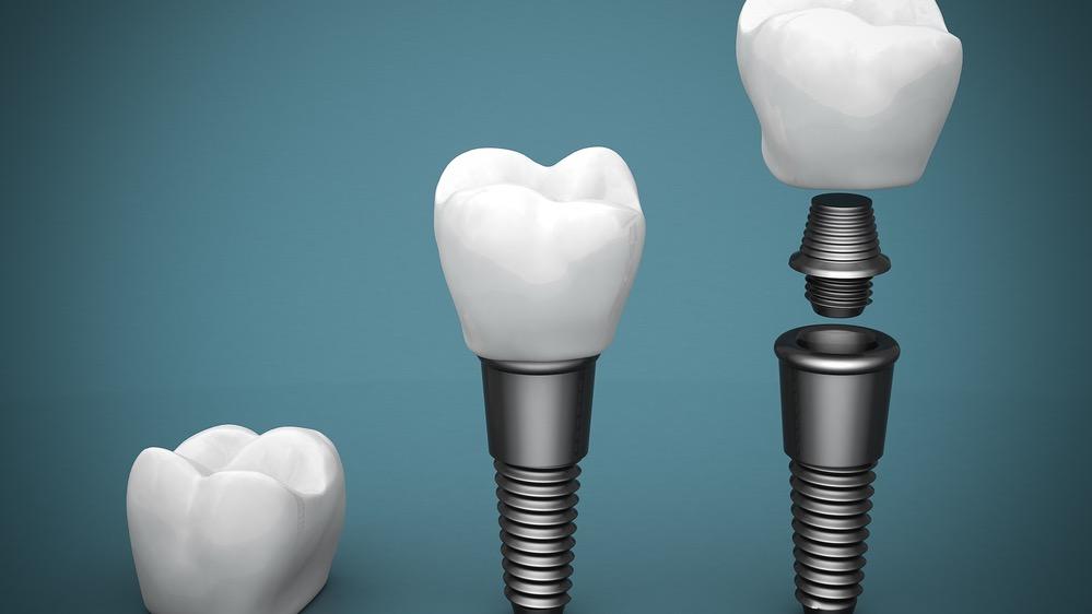 Kiwan Dental Care & Dental Implants Center photo 2