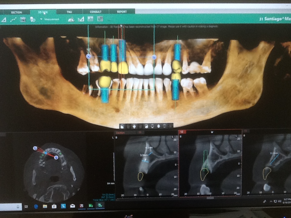 Kiwan Dental Care & Dental Implants Center photo 3