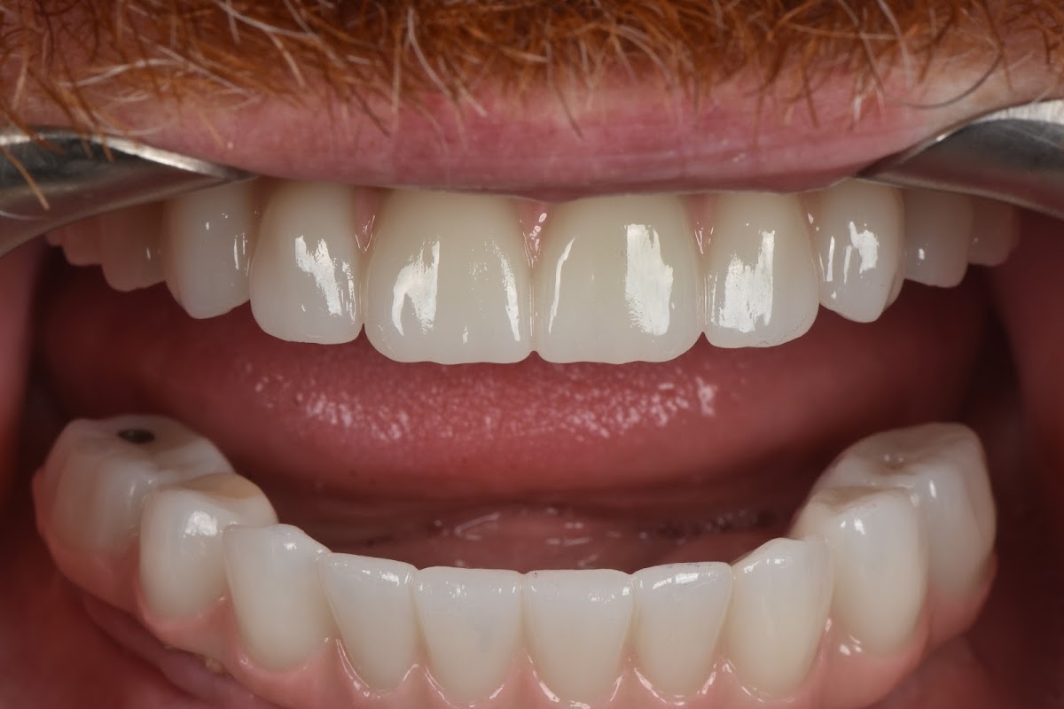 Aox Implant Studio photo 1