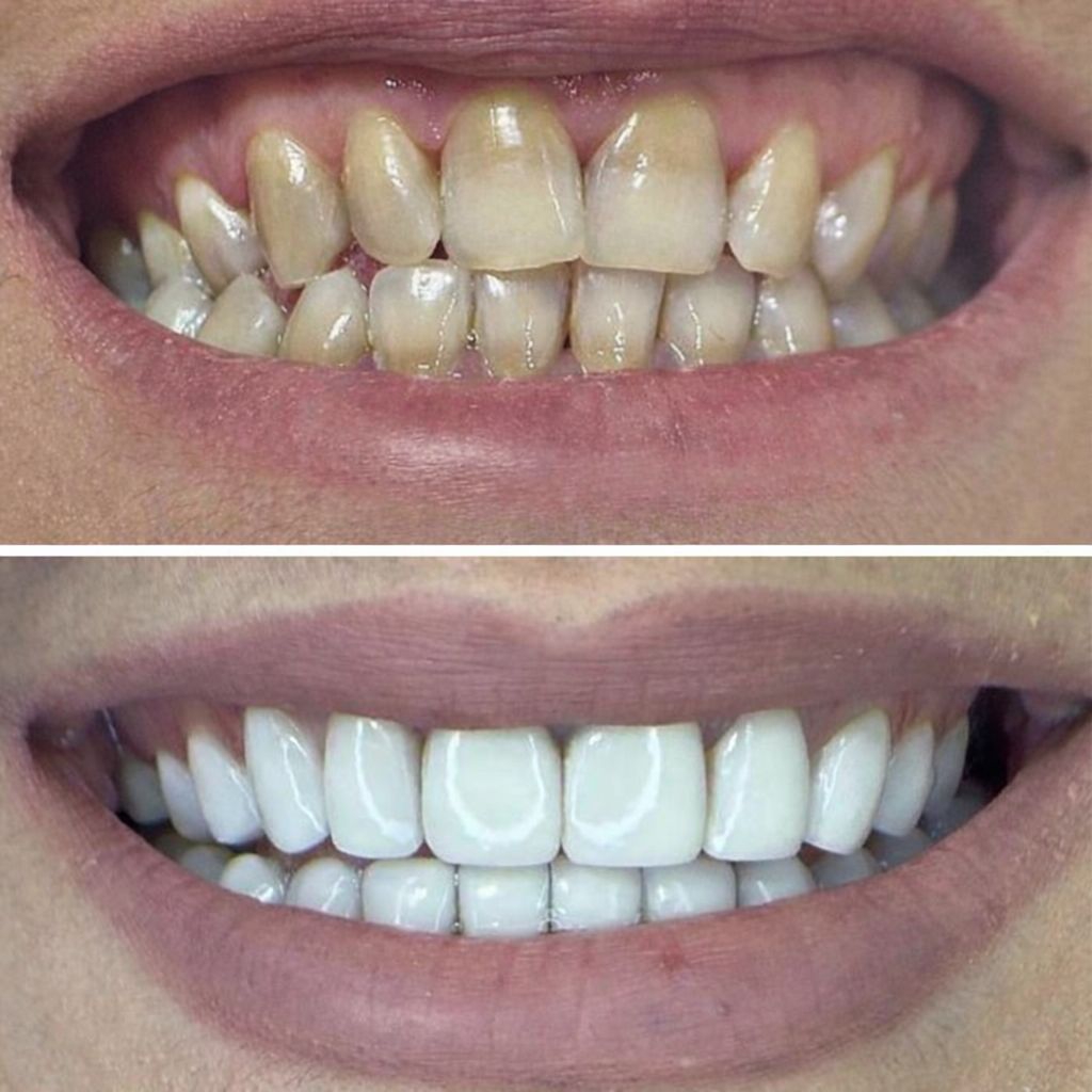 Eco Dental Implant Center photo 4
