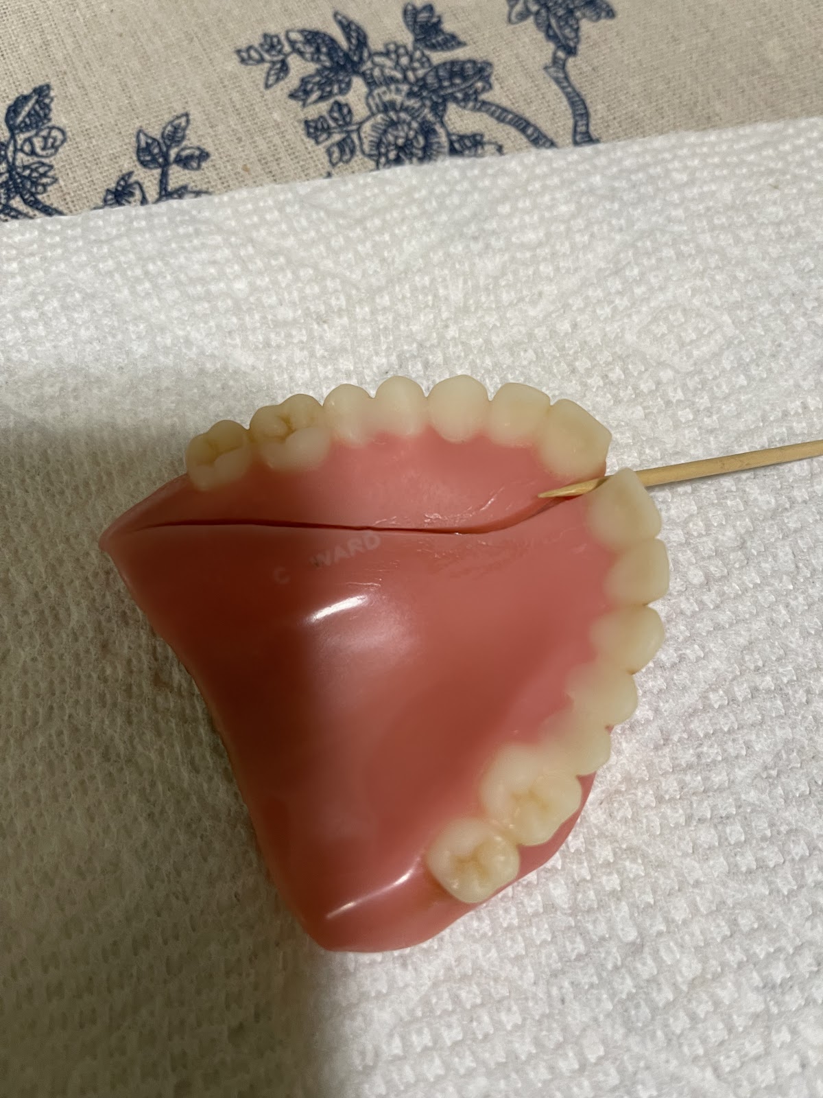 Aspen Dental - Hickory photo 4