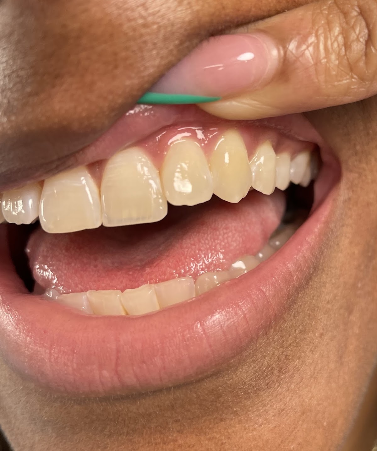 Aspen Dental - Coral Springs photo 1