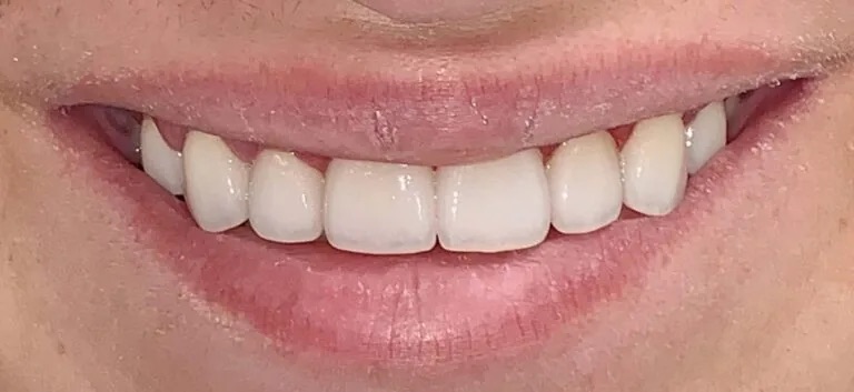 Winter Dental photo 5