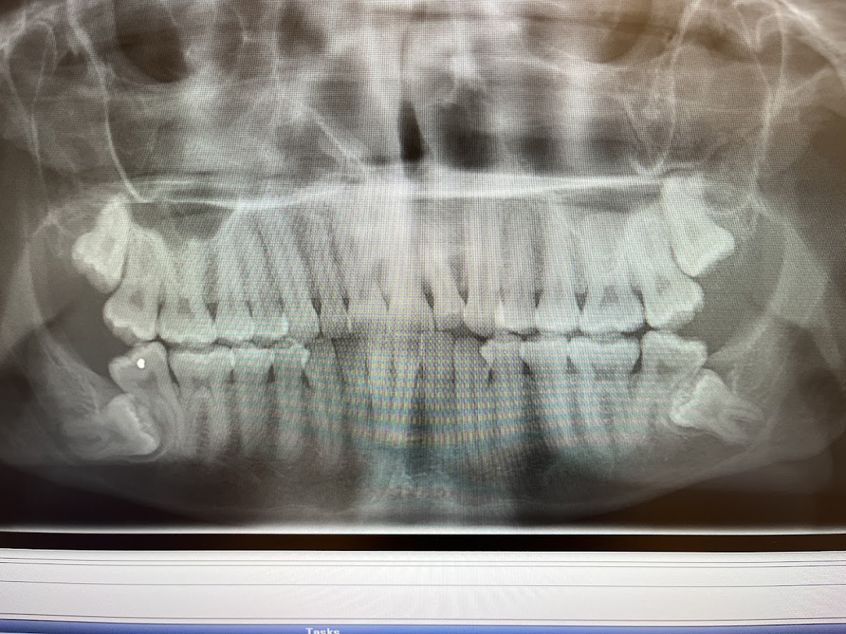 Omssc, Wisdom Teeth Removal & Sedation, Dr. Ali Board-Certified Oral Surgeon photo 5