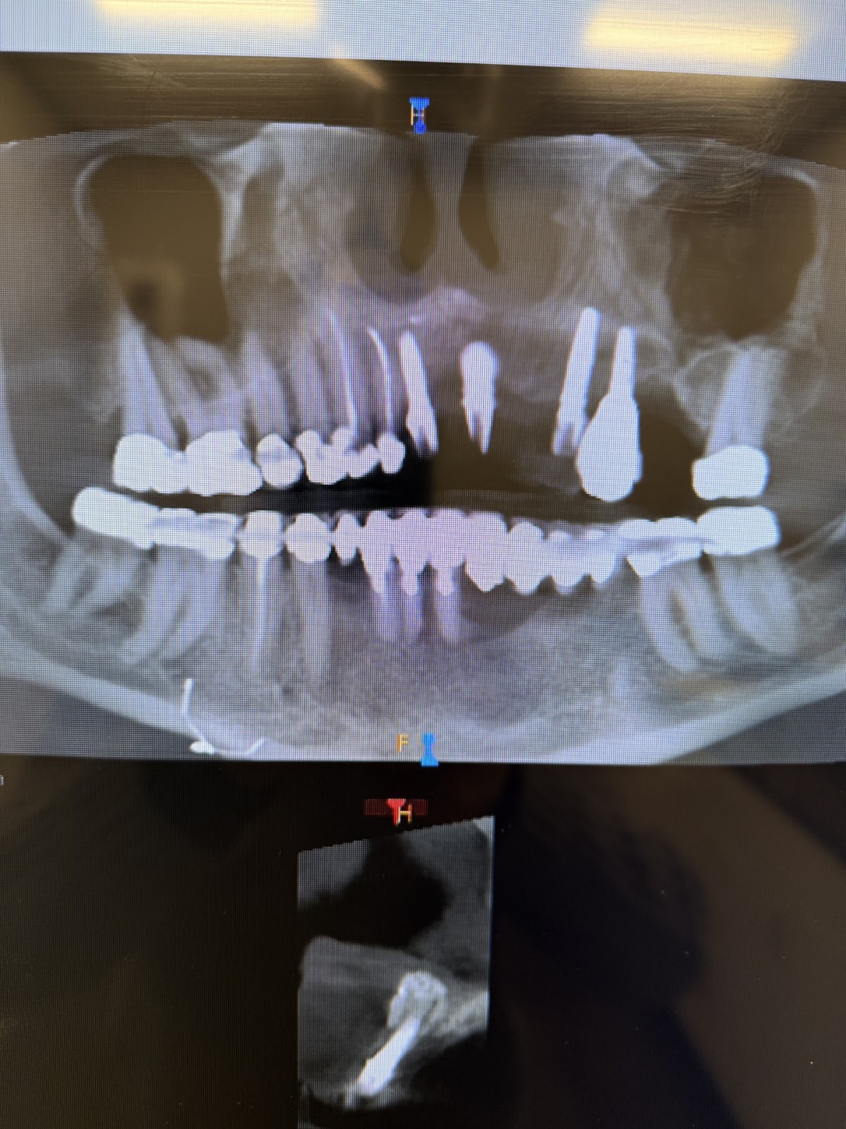 Forsyth Oral Surgery and Implant Center photo 4