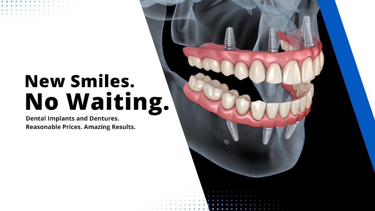 Santa Barbara Dental Implants photo 2
