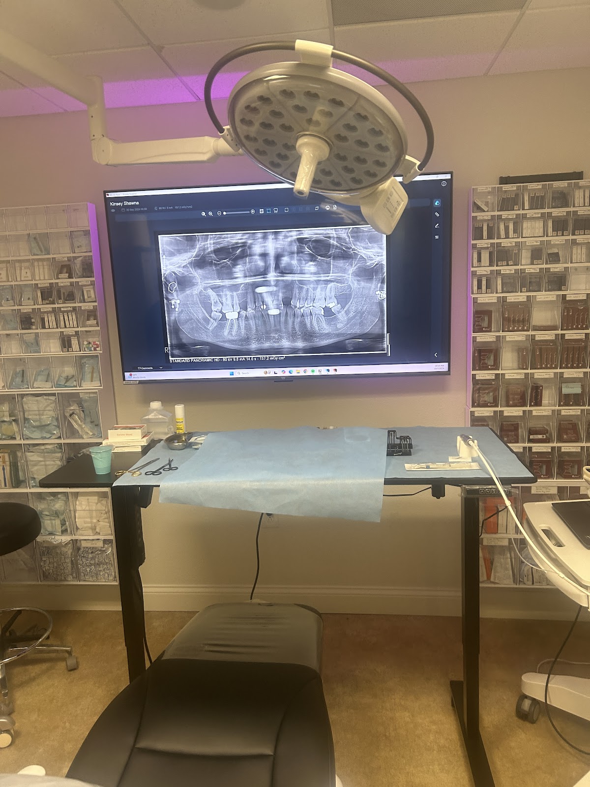 Santa Barbara Dental Implants photo 4