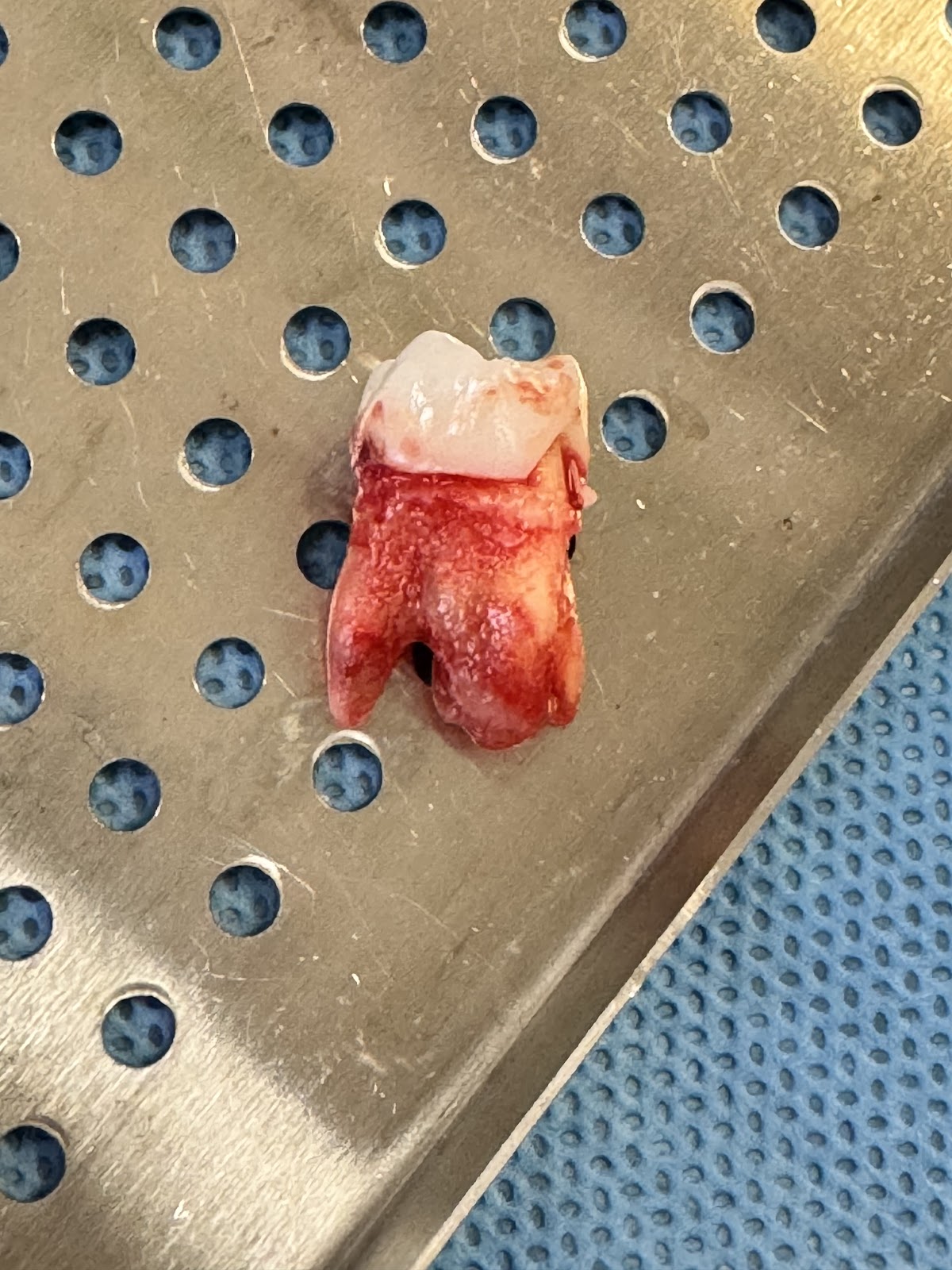 Aspen Dental - Glendale photo 4
