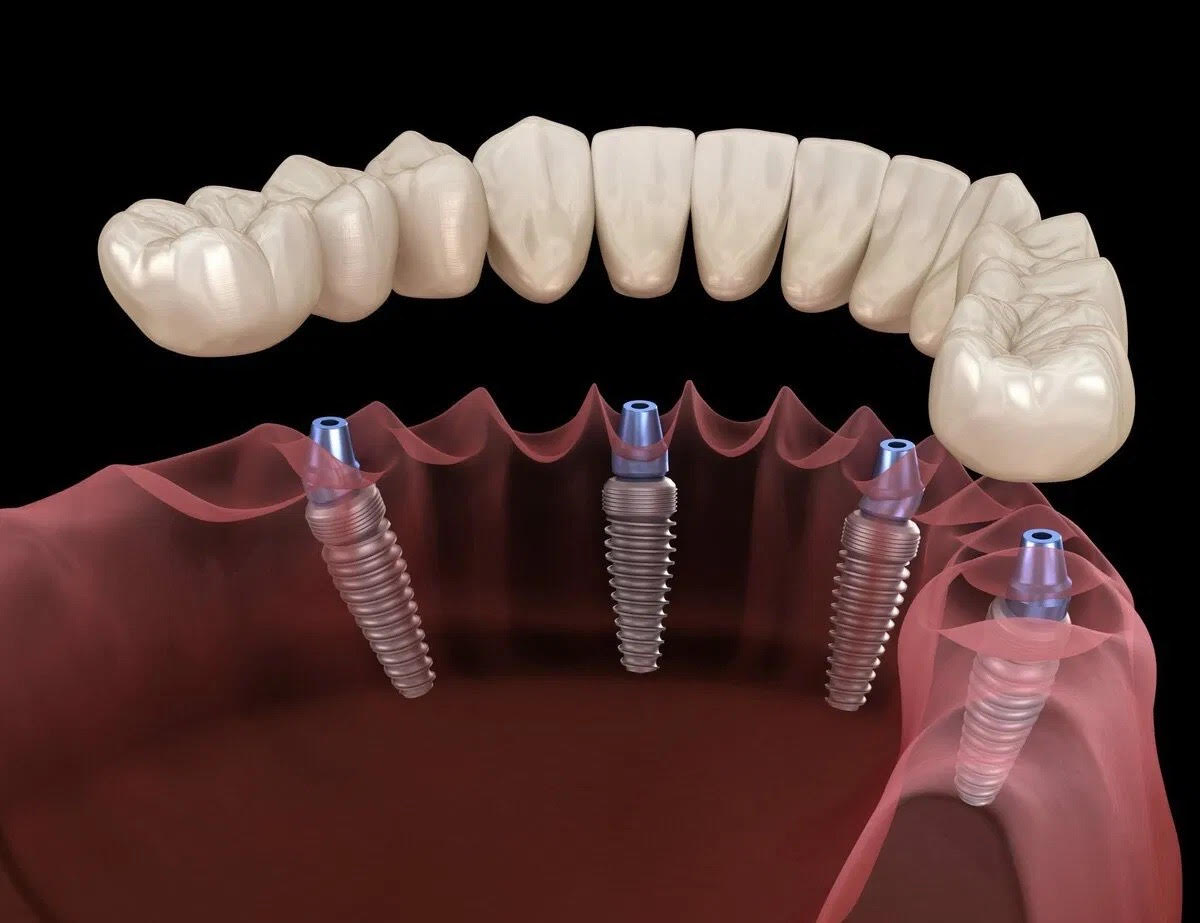 La Costa Family Dental And Implant Center photo 1
