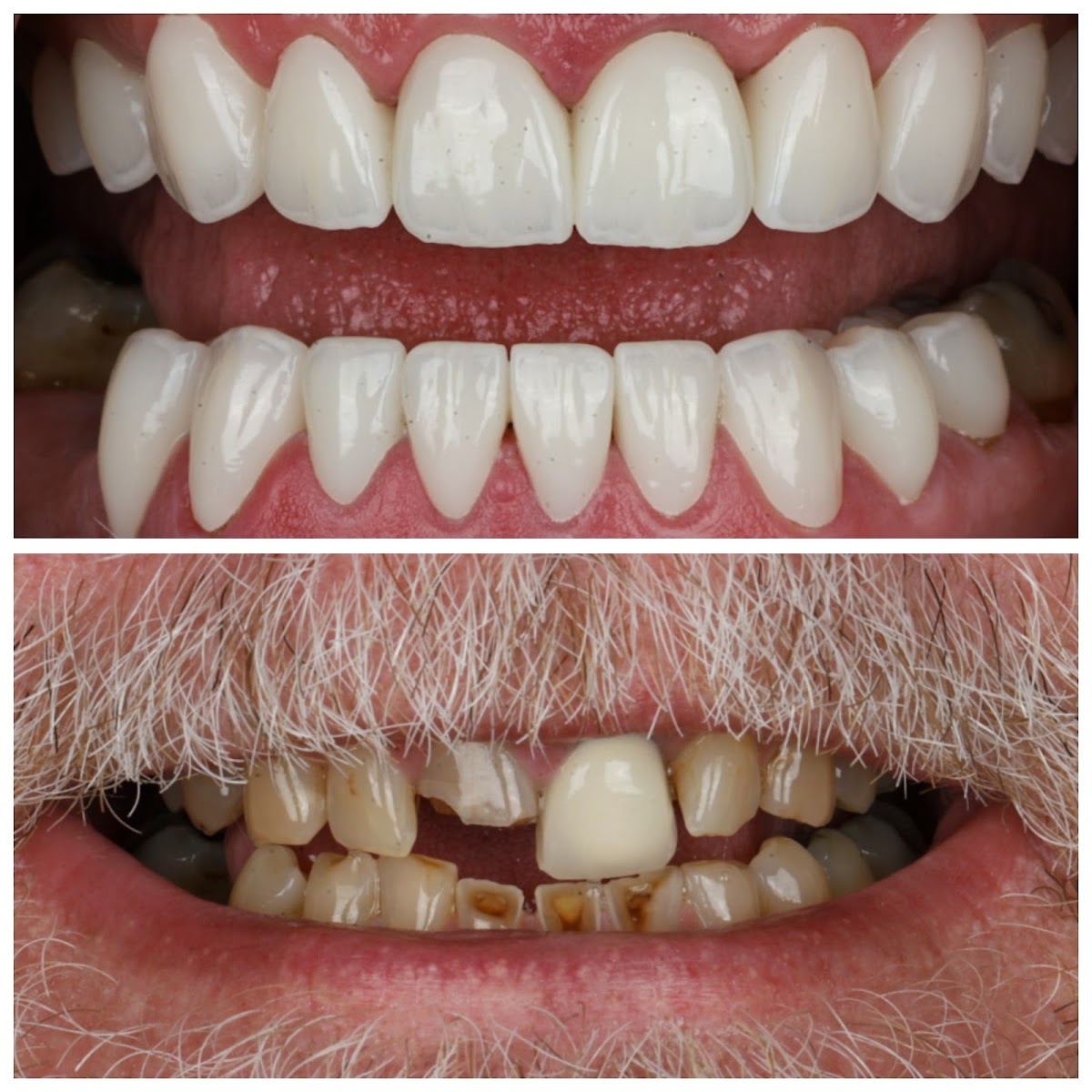 Main Street Implant & Family Dentistry, El Dorado, Ks Dentist photo 1
