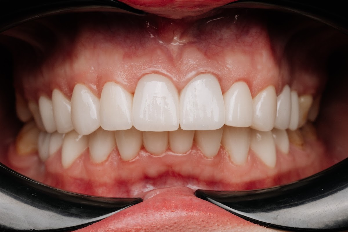 Pelican Dental Care photo 5
