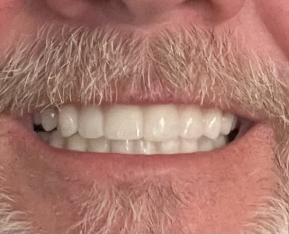 Dental Implant Center of Royal Oak photo 5