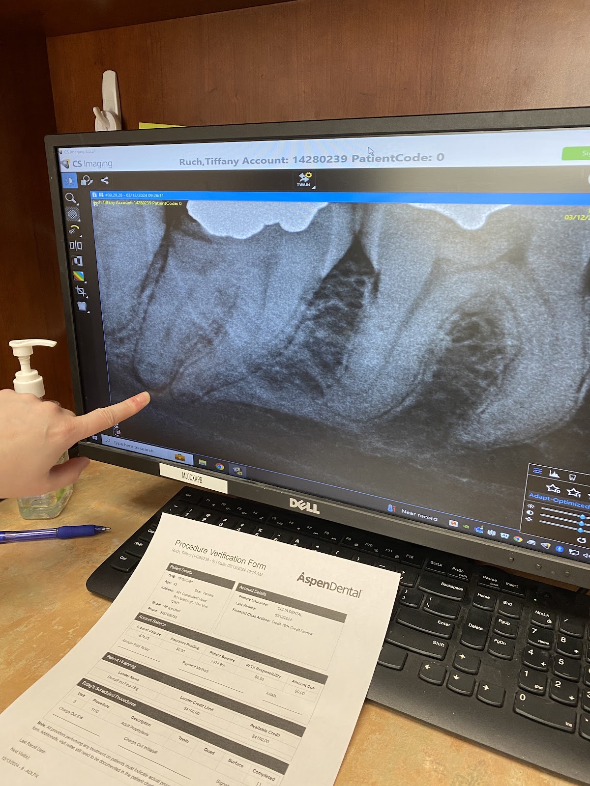 Aspen Dental - Plattsburgh photo 3