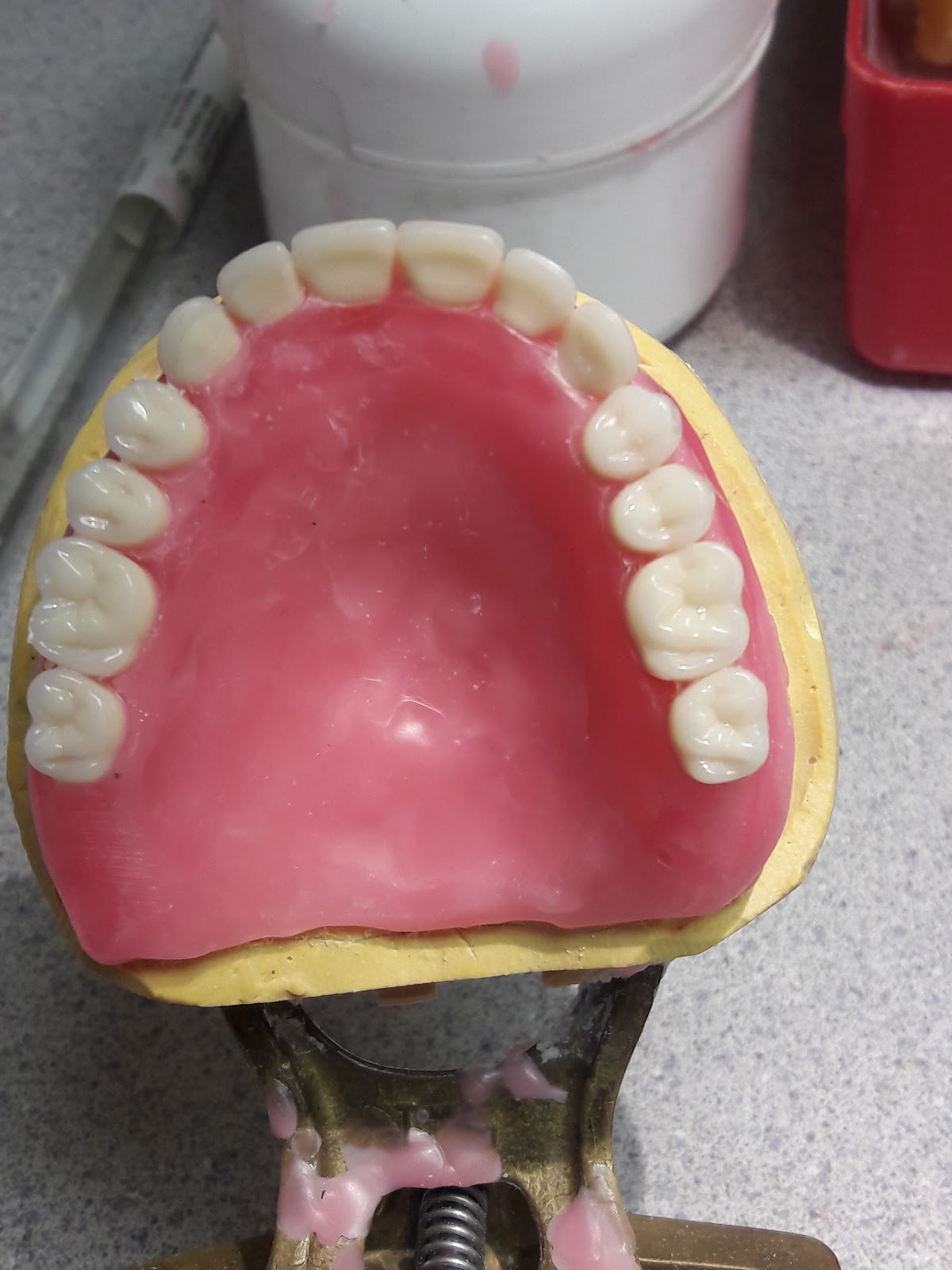 Affordable Dentures & Implants - West Collingswood Heights photo 5