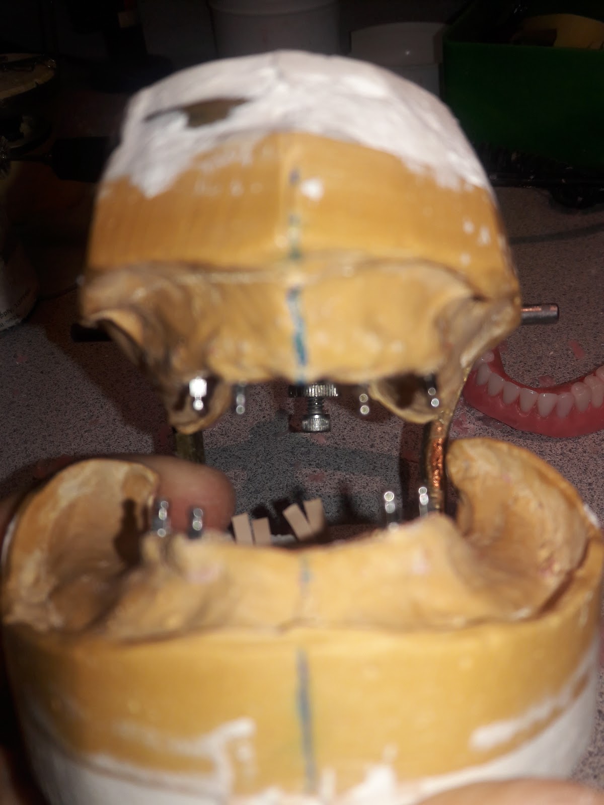 Affordable Dentures & Implants - West Collingswood Heights photo 6