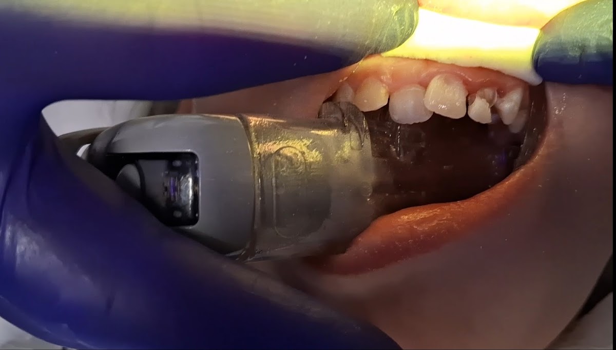 Gentle Dental Kids Medford photo 6