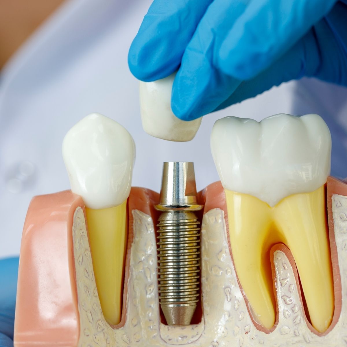 Center for Advanced Dentistry photo 3
