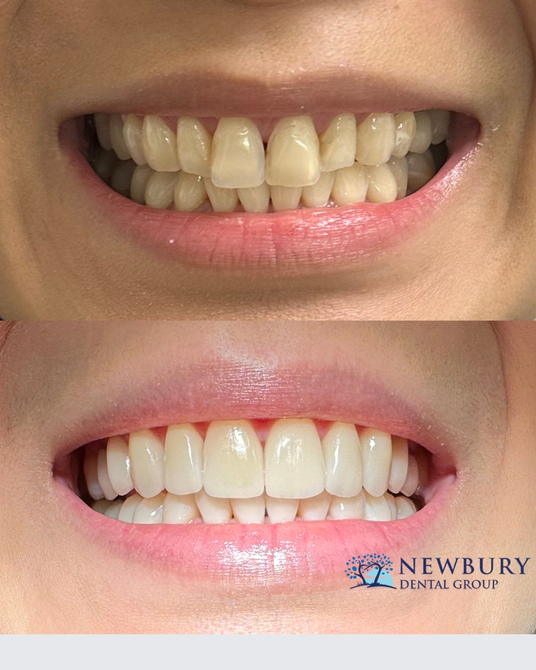 Newbury Dental Group - General, Invisalign, Veneers, Implants & Emergency Dentist photo 3