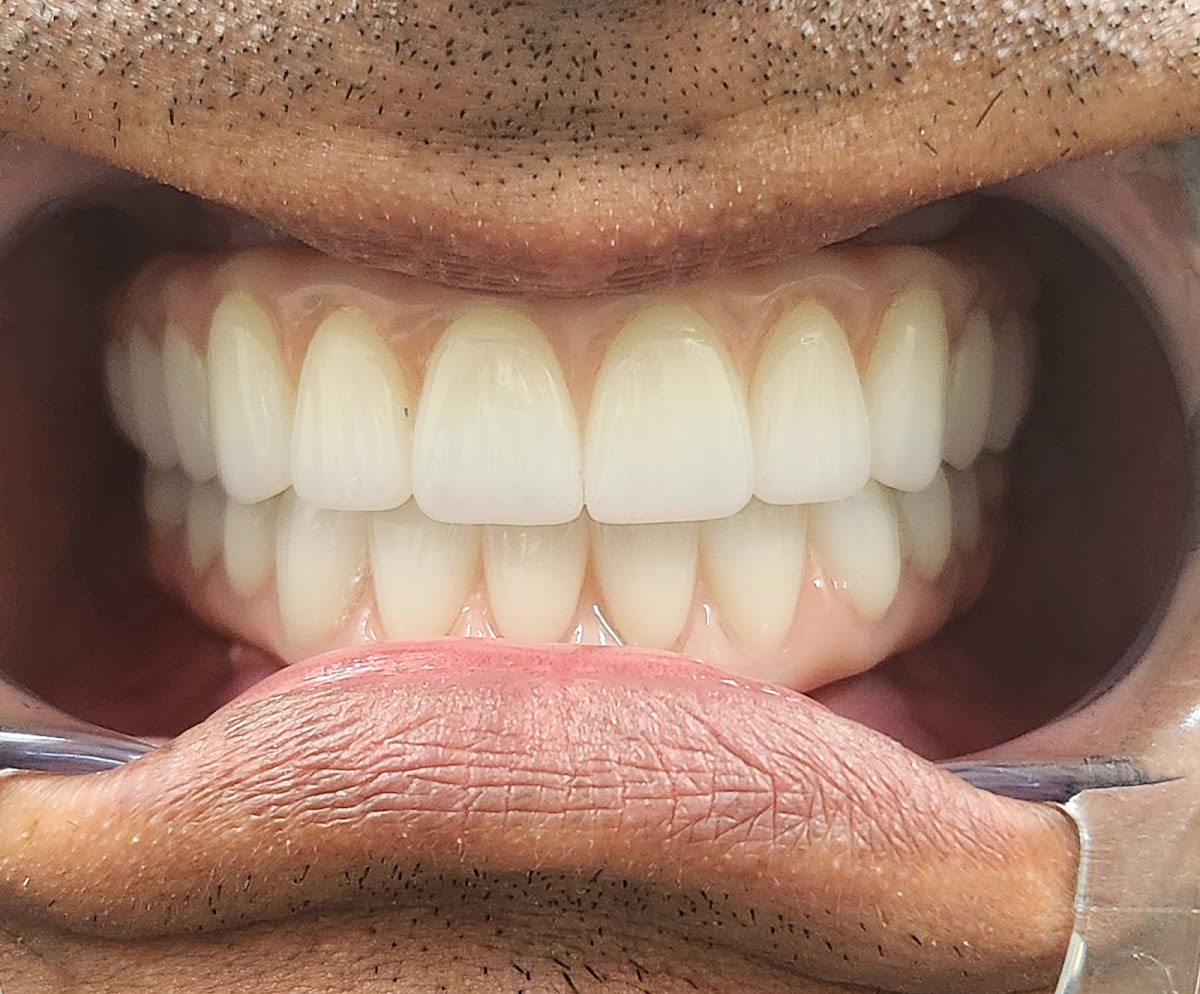 Wiand Dental Lab photo 5