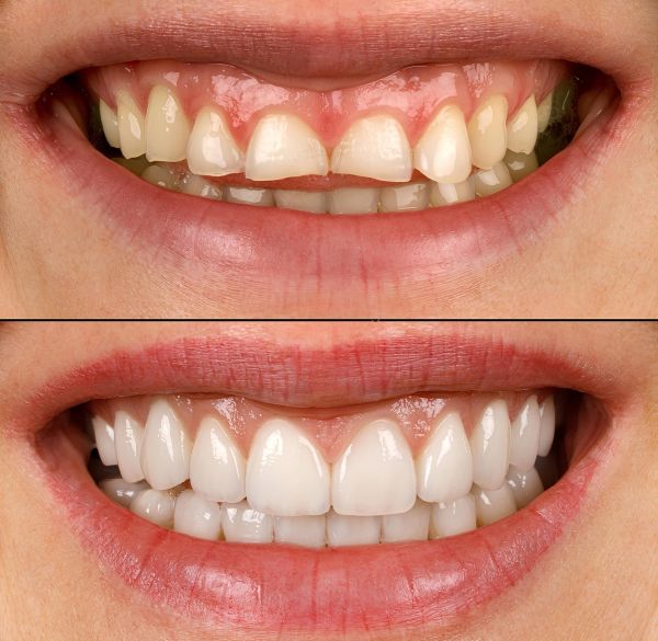 Total Dental & Denture Care photo 1