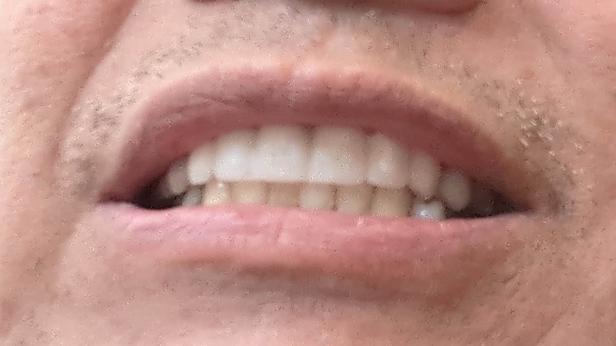 Cedar Creek Dental Care photo 3