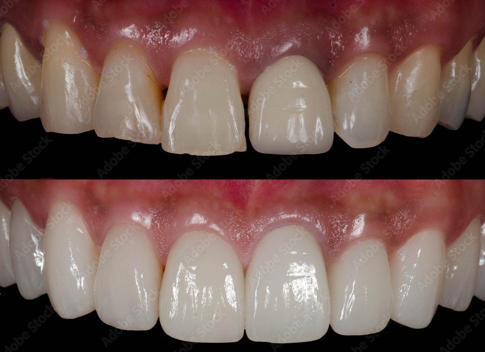 Jb Dental Designs photo 2