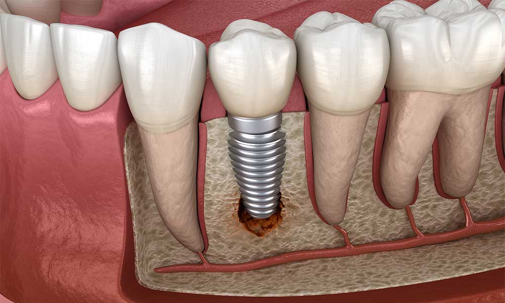 Jb Dental Designs photo 6