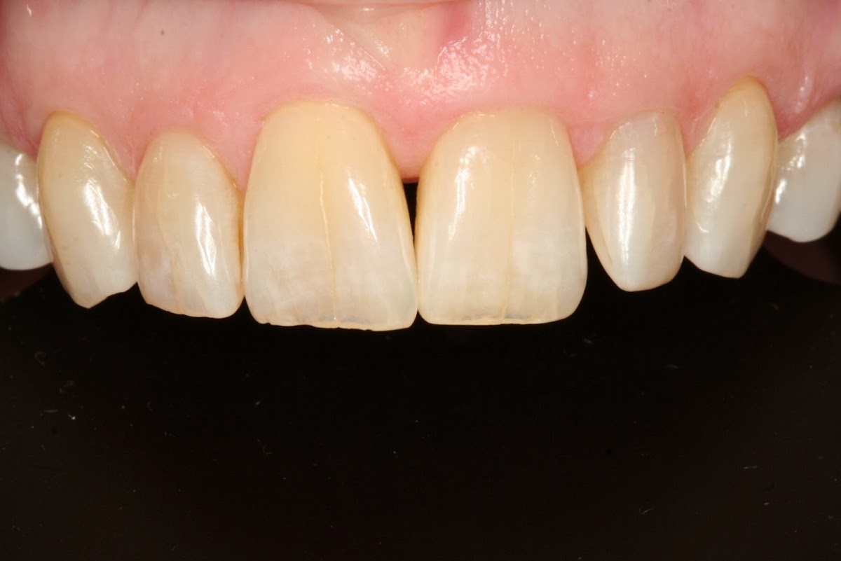 Mountain View Dental Center, Drs Charlie and Ute Collins photo 4