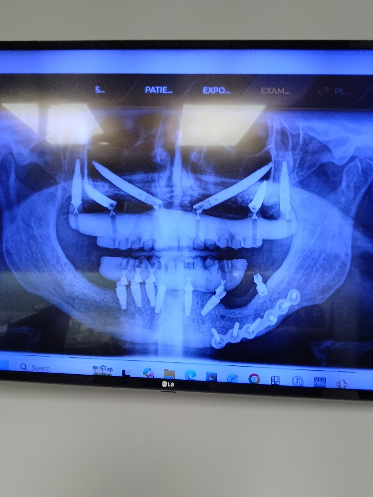 Valencia Periodontics photo 5