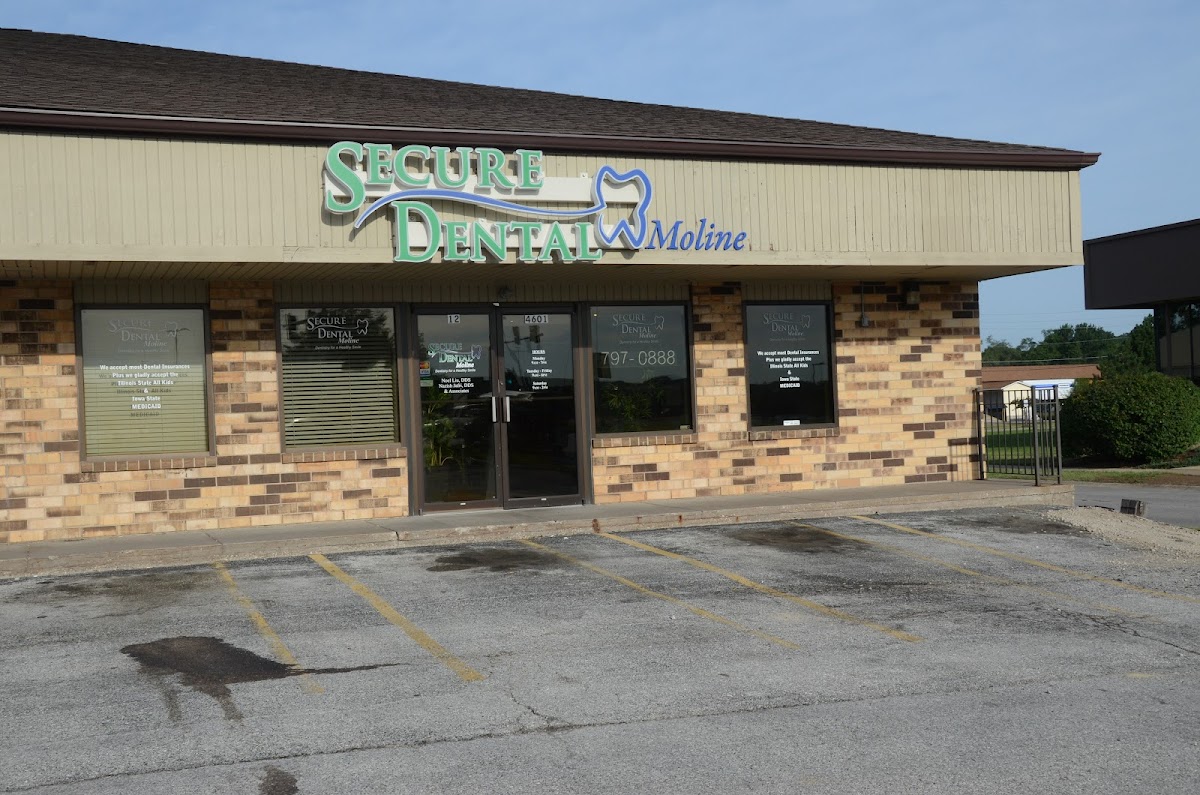 Secure Dental—moline photo 5