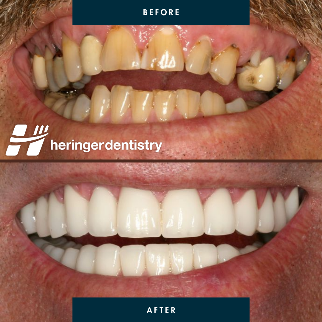 Heringer Dentistry LLC photo 3