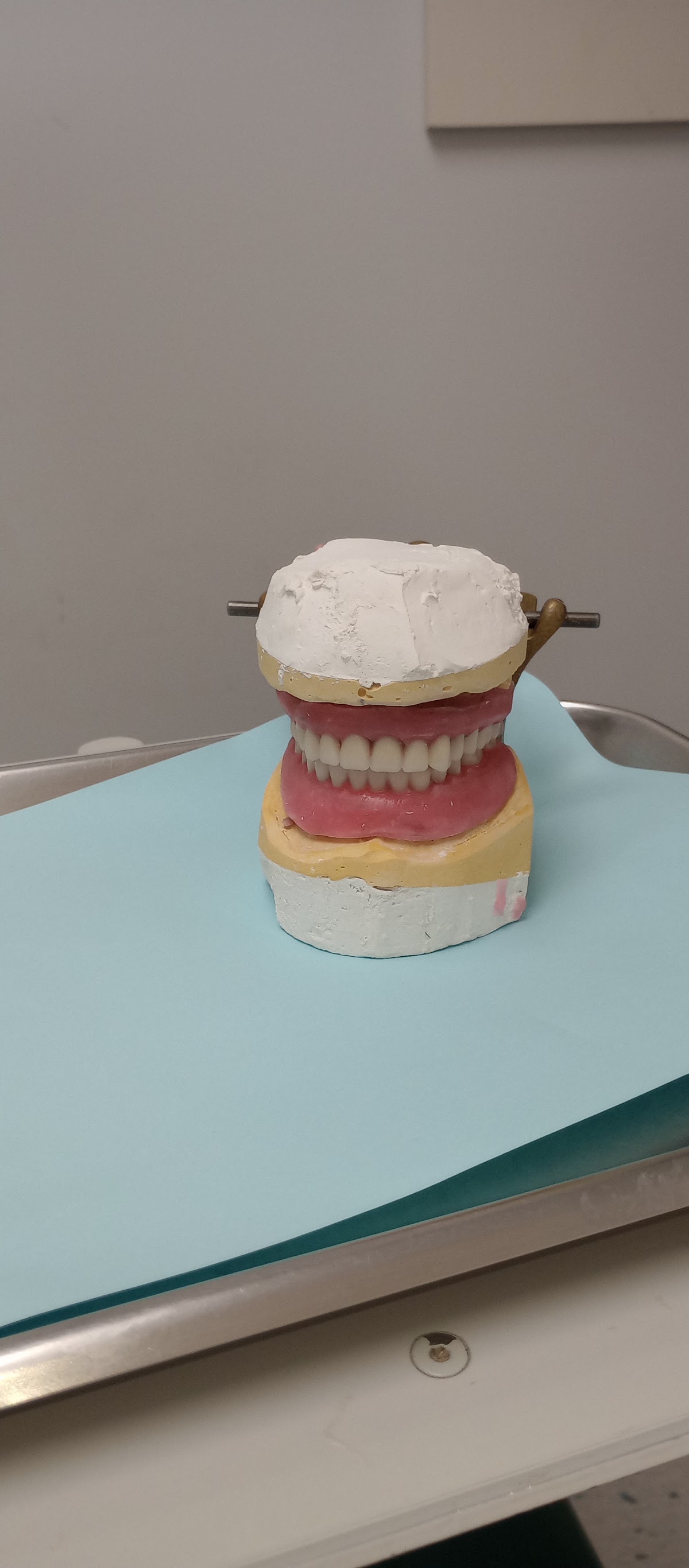 Affordable Dentures & Implants - Chester photo 6