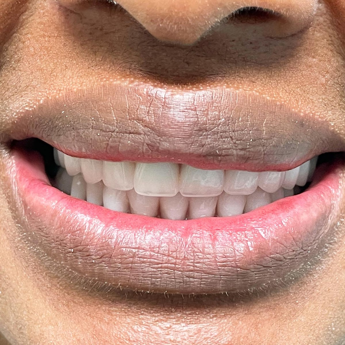 All In One Dentistry /Affordable Implants & Braces photo 3