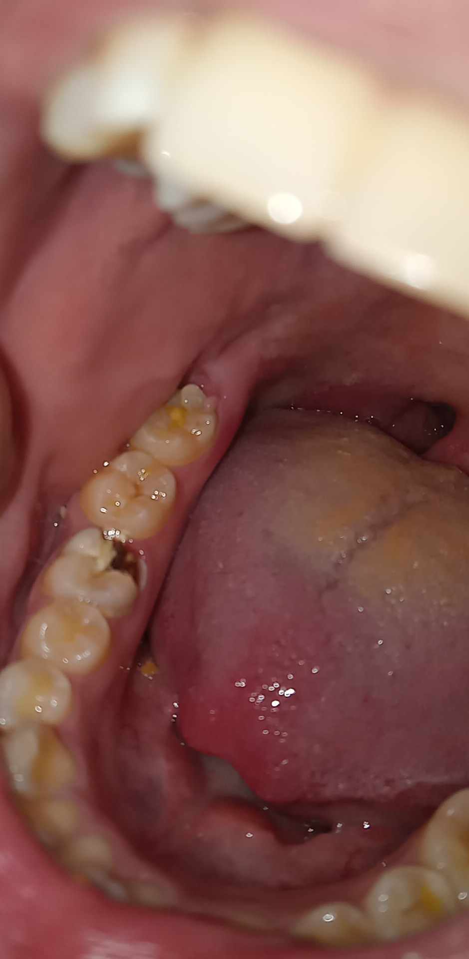 Tlc Dental Care photo 1