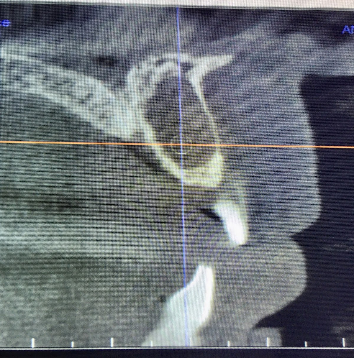 Archer Peak Oral Surgery photo 5