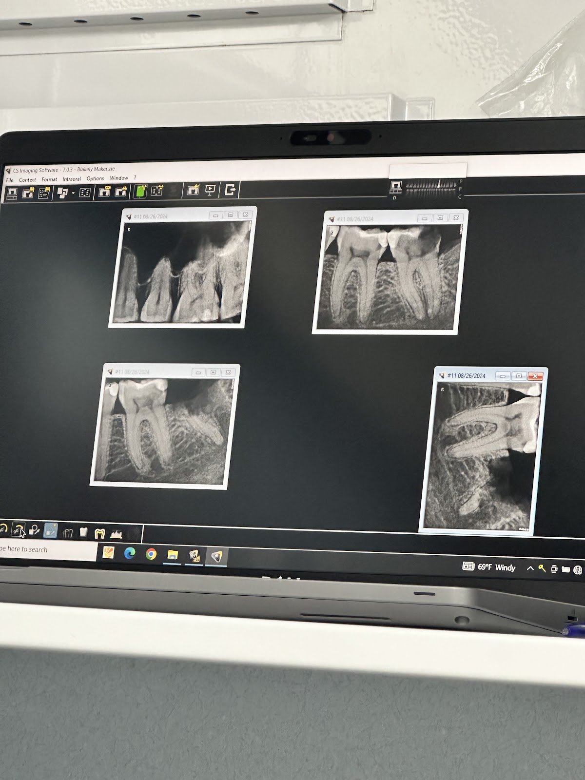 Aspen Dental - Spring Hill photo 6