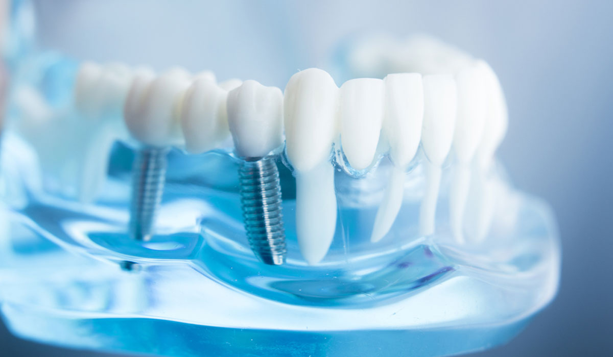 Fresh Family Dental photo 5
