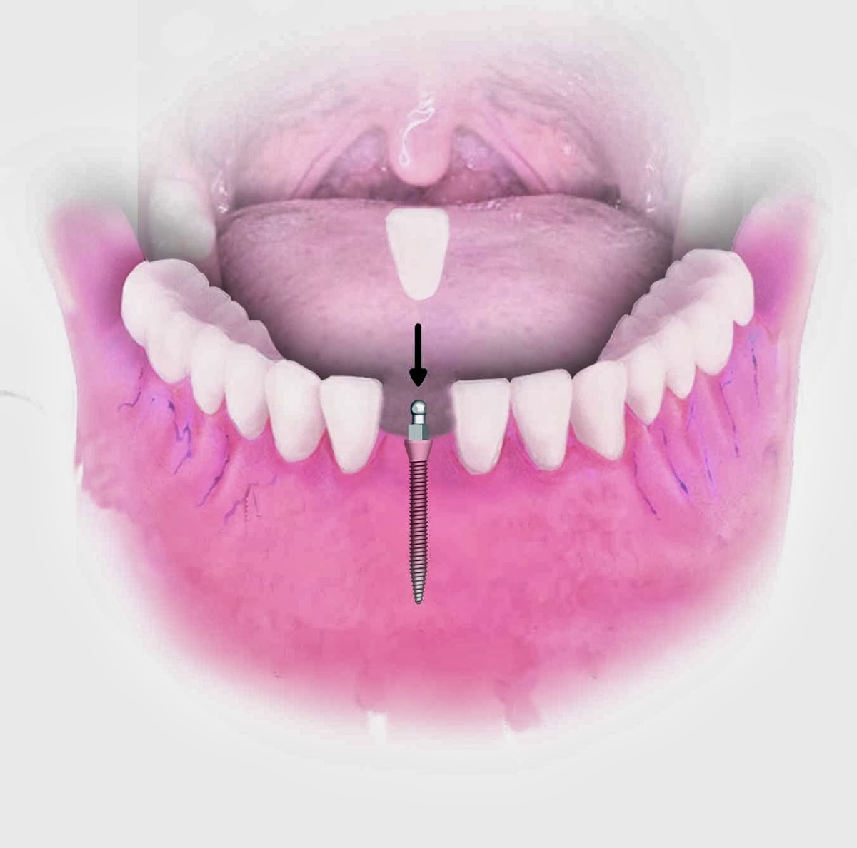 Keep Smiling Hartford Dental Implant Center photo 1
