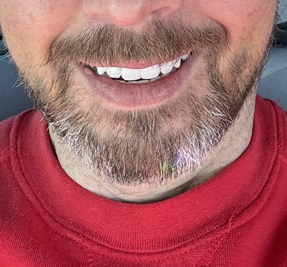 Altamonte Implant and Cosmetic Dentistry photo 3
