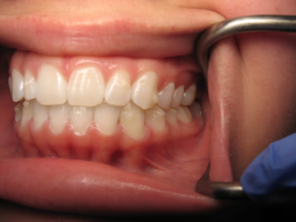 Hashimi Dental photo 1