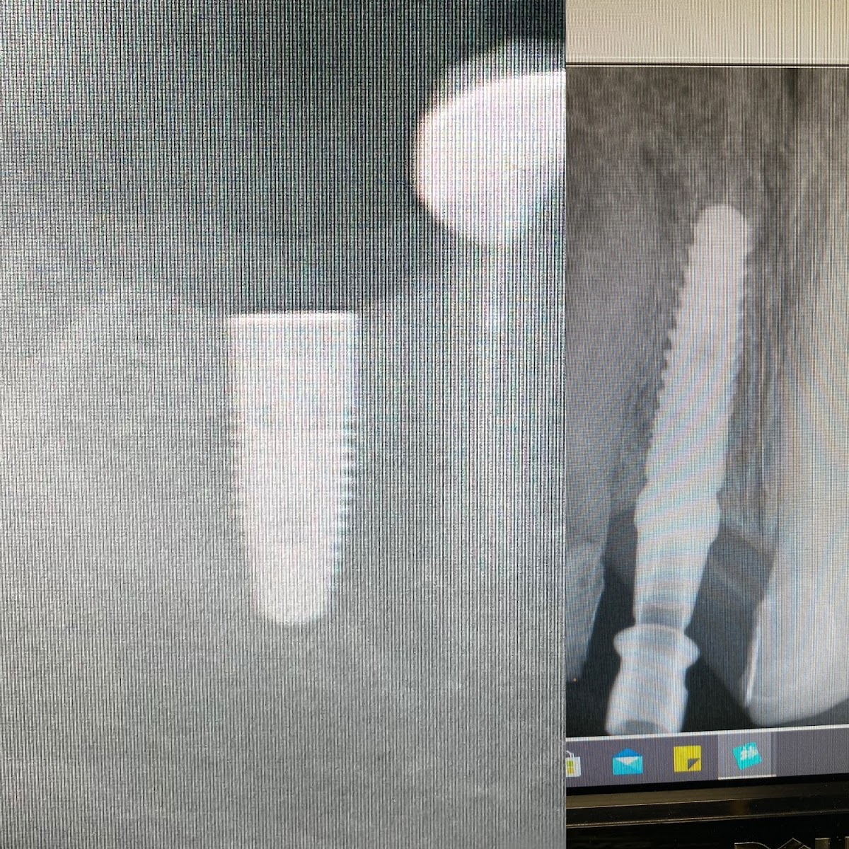 Hashimi Dental photo 6