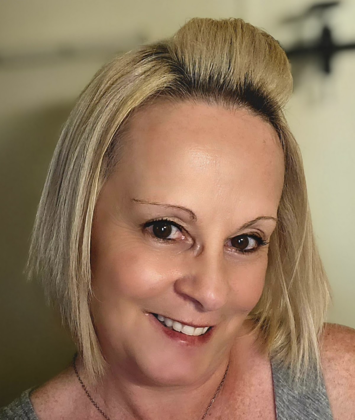 Affordable Dentures & Implants - South Charleston photo 5