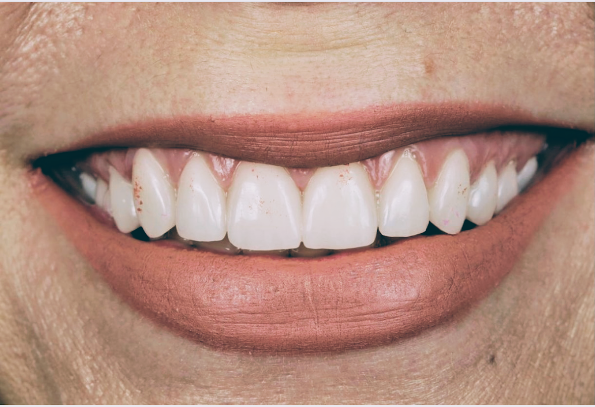 South Seattle Smiles photo 6